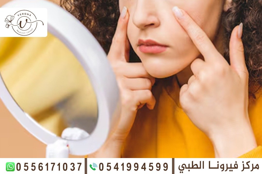 علاج مشاكل البشرة في الشارقة