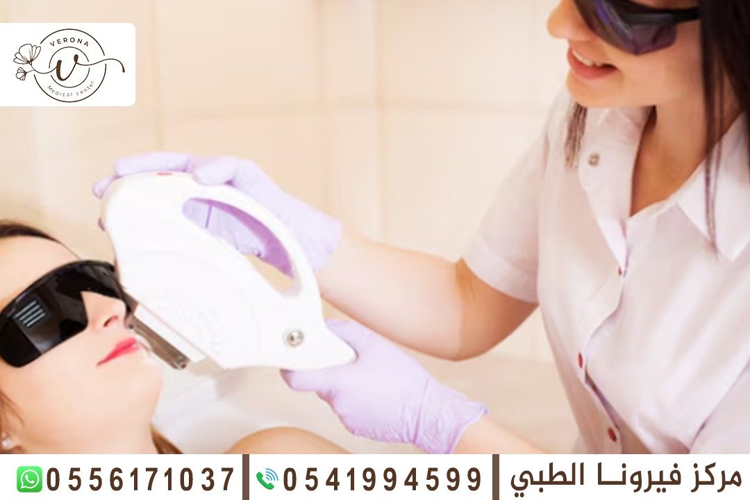 إزالة الشعر بالليزر في الشارقة
