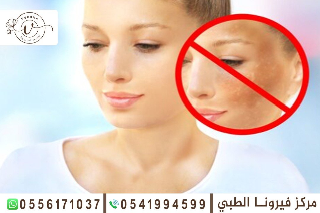 علاج مشاكل البشرة في الشارقة
