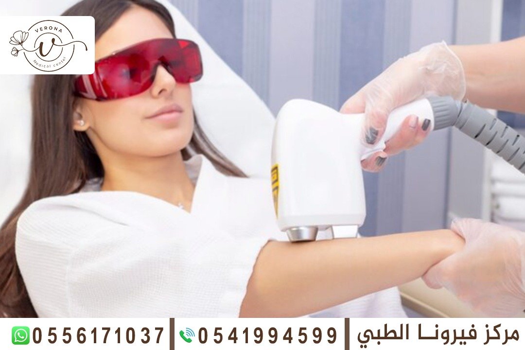 إزالة الشعر بالليزر في الشارقة