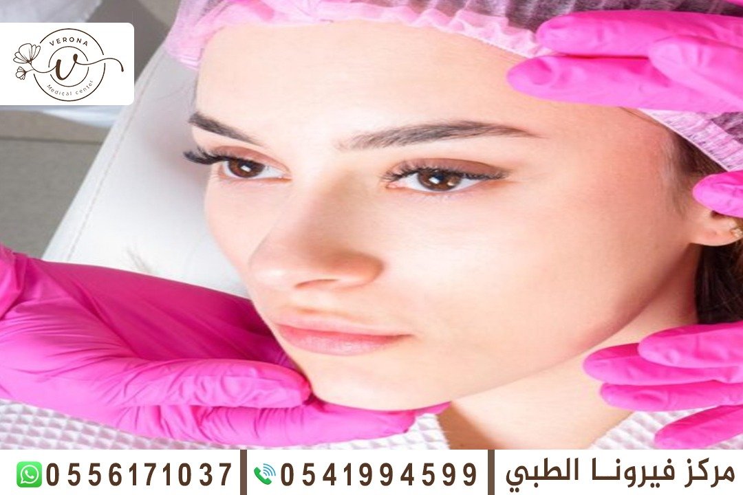 تفتيح البشرة في الشارقة