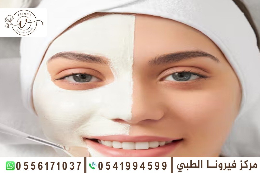 تفتيح البشرة في الشارقة