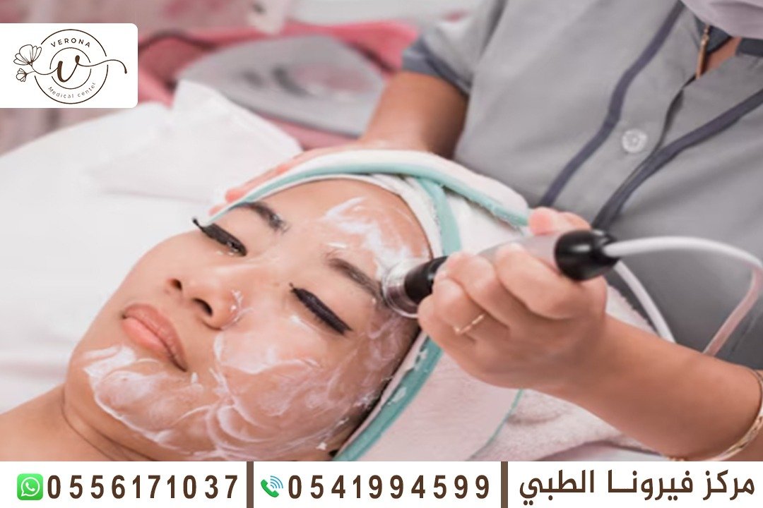 تنظيف البشرة في الشارقة