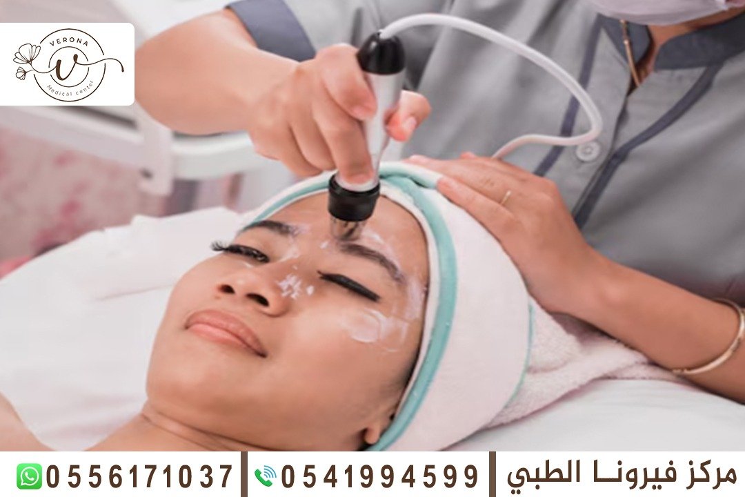 تنظيف البشرة في الشارقة